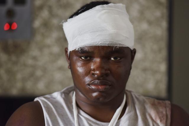Precious Amalsima at Kailash Hospital after the violent attack. (Virendra Singh Gosain/HT PHOTO) Precious Amalsima at Kailash Hospital after the violent attack. (Virendra Singh Gosain/HT PHOTO)