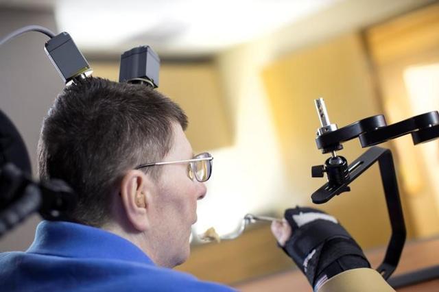 Kochevar underwent brain surgery where sensors were fitted in the motor cortex – area of brain responsible for hand movement. (Reuters) Kochevar underwent brain surgery where sensors were fitted in the motor cortex – area of brain responsible for hand movement. (Reuters)