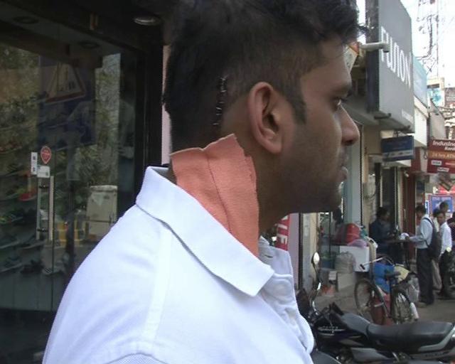 One of youths, who were assaulted at The Wine Company in Gurgaon’s CyberHub on Monday night. (HT Photo) One of youths, who were assaulted at The Wine Company in Gurgaon’s CyberHub on Monday night. (HT Photo)