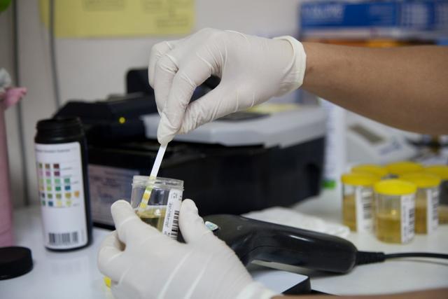 To determine which molecules wafting from urine could indicate prostate cancer, the researchers collected urine samples from 100 men undergoing prostate biopsies. (Shutterstock) To determine which molecules wafting from urine could indicate prostate cancer, the researchers collected urine samples from 100 men undergoing prostate biopsies. (Shutterstock)