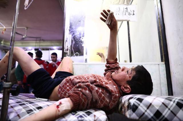 A wounded Syrian youth gestures at a makeshift clinic following reported air strikes by government forces in the rebel-held town of Douma. (AFP Photo) A wounded Syrian youth gestures at a makeshift clinic following reported air strikes by government forces in the rebel-held town of Douma. (AFP Photo)