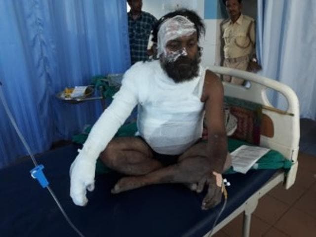 Suraj Baitha, who tried to immolate himself, undergoing treatment at a local private hospital in Motihari before being referred to the Patna Medical College Hospital on Monday. (Madnakar/HT photo)