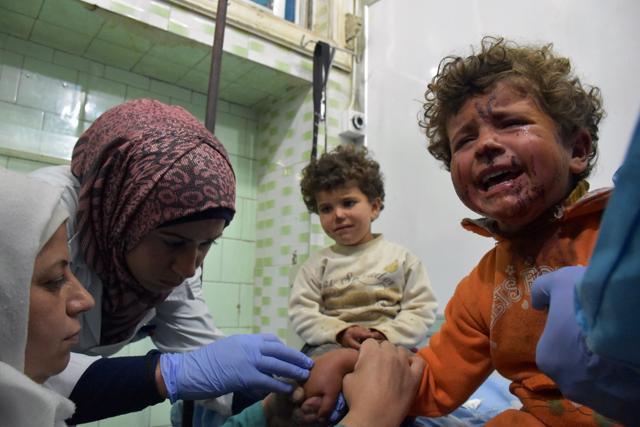 Syrian children, wounded in a suicide car bombing that targeted their buses in Rashidin, west of Aleppo on April 15. (AFP Photo) Syrian children, wounded in a suicide car bombing that targeted their buses in Rashidin, west of Aleppo on April 15. (AFP Photo)