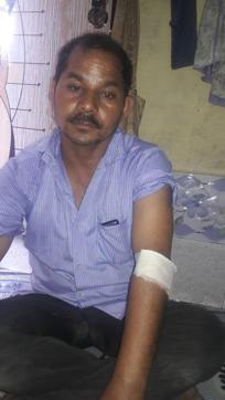 Shukla suffered injuries on his left arm. (HT) Shukla suffered injuries on his left arm. (HT)