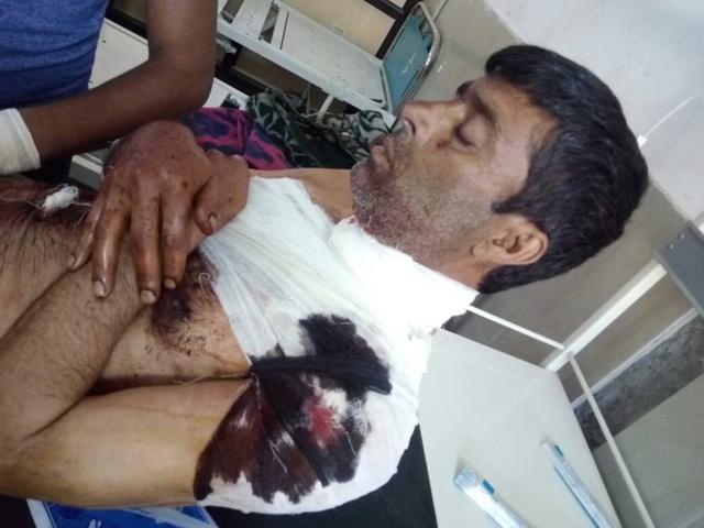 One of the injured special police officers undergoing treatment at Doda district hospital. (HT Photo) One of the injured special police officers undergoing treatment at Doda district hospital. (HT Photo)