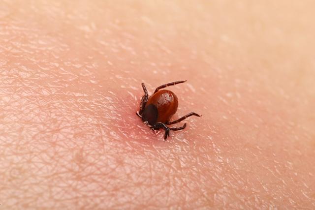 If you’ve spent time in areas where ticks live, in particular long grass, check your body for ticks once home. The tick needs to be removed as soon as possible to avoid infection. (Shutterstock) If you’ve spent time in areas where ticks live, in particular long grass, check your body for ticks once home. The tick needs to be removed as soon as possible to avoid infection. (Shutterstock)