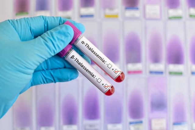 Being informed about the disorder is not a guarantee on preventive or corrective measures for the unborn child. (Shutterstock) Being informed about the disorder is not a guarantee on preventive or corrective measures for the unborn child. (Shutterstock)