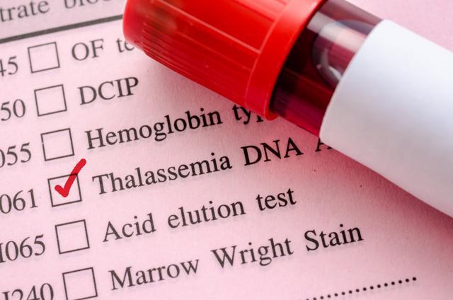 This time doctors have aimed to encourage blood donation and spread increased awareness to women carrying the gene to protect their unborn child. (Shutterstock) This time doctors have aimed to encourage blood donation and spread increased awareness to women carrying the gene to protect their unborn child. (Shutterstock)