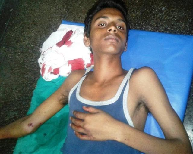 The injured Golu Kumar. (HT photo) The injured Golu Kumar. (HT photo)