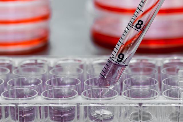 The downside, say researchers, is that immunotherapy can cause the immune system to overreact or under-react. (Shutterstock) The downside, say researchers, is that immunotherapy can cause the immune system to overreact or under-react. (Shutterstock)