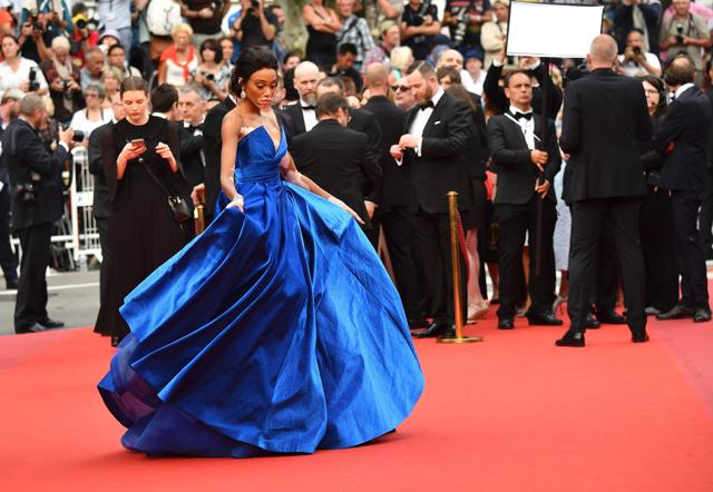 Winnie Harlow poses for photos. (AFP)