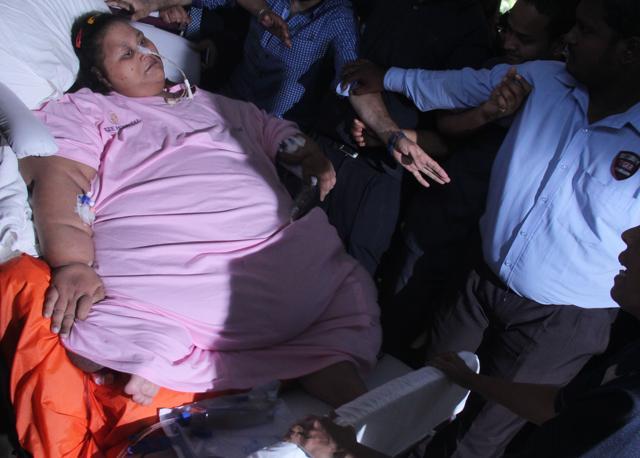 Egyptian woman Eman Ahmed underwent a weight-loss surgery at a Mumbai hospital. (Bhushan Koyande/HT File Photo) Egyptian woman Eman Ahmed underwent a weight-loss surgery at a Mumbai hospital. (Bhushan Koyande/HT File Photo)