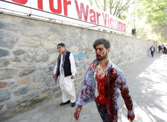 An injured man arrives at a hospital after a blast in Kabul. (Reuters Photo) An injured man arrives at a hospital after a blast in Kabul. (Reuters Photo)
