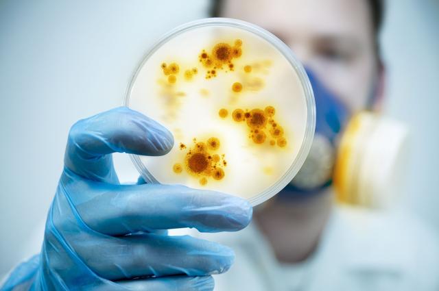 Sepsis is triggered by an infection in the body; the body’s immune system releases chemicals that fight the infection, but also cause widespread inflammation. (iStock) Sepsis is triggered by an infection in the body; the body’s immune system releases chemicals that fight the infection, but also cause widespread inflammation. (iStock)