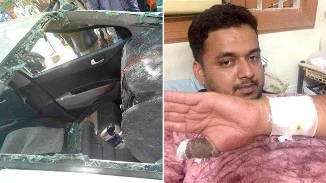 The car’s owner, Pankaj Joshi , suffered injuries on his arms. He managed to pull himself out of his damaged vehicle. (HT Photo) The car’s owner, Pankaj Joshi , suffered injuries on his arms. He managed to pull himself out of his damaged vehicle. (HT Photo)