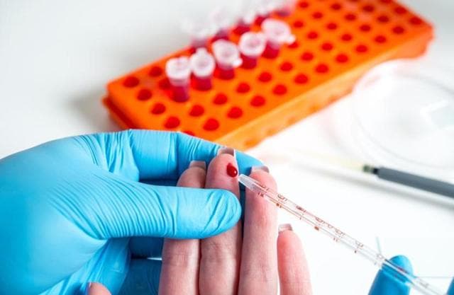 Researchers found that the levels of two proteins previously identified as potential markers for autism spectrum disorder. (Shutterstock) Researchers found that the levels of two proteins previously identified as potential markers for autism spectrum disorder. (Shutterstock)