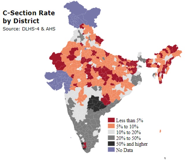 Caesarean section delivery rates reveal need for smarter healthcare