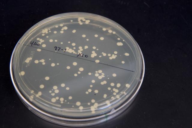 A petri dish containing live yeast cultures at a New York University labe at the Alexandria Center for Life Sciences in New York, where researchers are attempting to create completely man-made, custom-built DNA. (AP Photo) A petri dish containing live yeast cultures at a New York University labe at the Alexandria Center for Life Sciences in New York, where researchers are attempting to create completely man-made, custom-built DNA. (AP Photo)