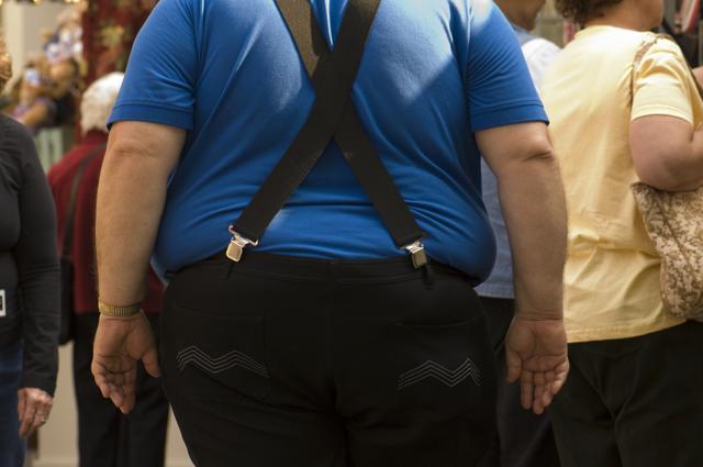 Watch your Body Mass Index levels before you opt for a weight-loss surgery. (iStock)