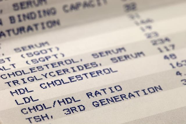 Keeping your cholesterol levels under check is a great way to keep your heart healthy. (Shutterstock)