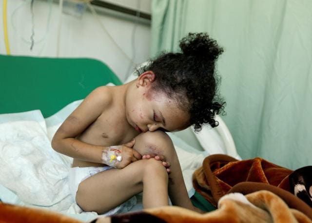 Buthaina Muhammad Mansour, believed to be four or five, sits on a bed at a hospital after she survived a Saudi-led air strike that killed eight of her family members in Sanaa, Yemen August 26, 2017. REUTERS/Khaled Abdullah (REUTERS) Buthaina Muhammad Mansour, believed to be four or five, sits on a bed at a hospital after she survived a Saudi-led air strike that killed eight of her family members in Sanaa, Yemen August 26, 2017. REUTERS/Khaled Abdullah (REUTERS)