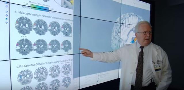 The research team produced a highly detailed 3D map of Fabbio’s brain - with both the location of the tumour and music function. (Screengrab from YouTube video uploaded by UR Medicine)