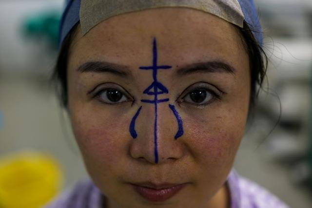 In this photograph taken on August 22, 2017, Chen Yan, 35, poses for a photograph before her plastic surgery procedure at Huamei Medical Cosmetology Hospital in Shanghai. (AFP) In this photograph taken on August 22, 2017, Chen Yan, 35, poses for a photograph before her plastic surgery procedure at Huamei Medical Cosmetology Hospital in Shanghai. (AFP)