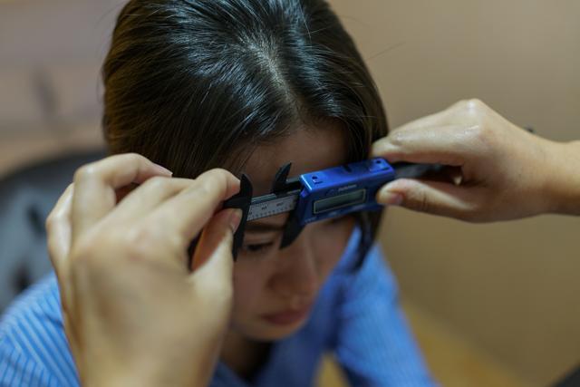 In this photograph taken on September 21, 2017, doctor Wang Yang takes measurements during a consultation with Yu Linlin at Huamei Medical Cosmetology Hospital in Shanghai. (AFP) In this photograph taken on September 21, 2017, doctor Wang Yang takes measurements during a consultation with Yu Linlin at Huamei Medical Cosmetology Hospital in Shanghai. (AFP)