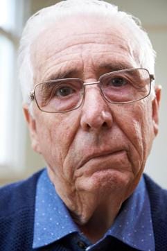 A stroke patient’s face droops on one side when the person tries to smile. (Shutterstock) A stroke patient’s face droops on one side when the person tries to smile. (Shutterstock)