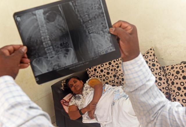 Surekha Ujgare (45), Injured after PMPML bus driver put urgent breaks to avoid collision with a car at her residence with husband Haridas Ujgare in Dhayari in Pune on Saturday. (Pratham Gokhale/HT Photo)
