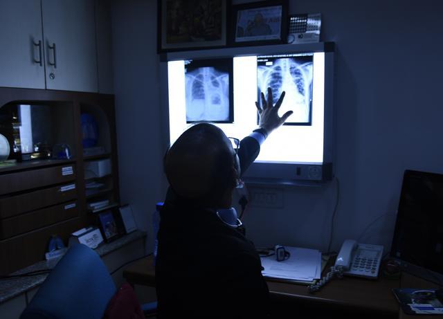 A doctor at Delhi’s Indraprastha Apollo Hospital examines a patient’s X-ray report. (Sanchit Khanna/ HT Photo) A doctor at Delhi’s Indraprastha Apollo Hospital examines a patient’s X-ray report. (Sanchit Khanna/ HT Photo)