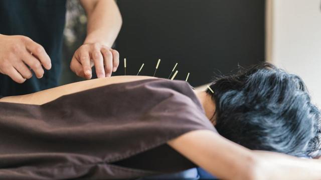 Acupuncure involves inserting thin needles at specific points on the body to stimulate nerves, muscles and connective tissue. (Shutterstock) Acupuncure involves inserting thin needles at specific points on the body to stimulate nerves, muscles and connective tissue. (Shutterstock)
