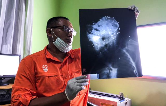 A photograph shows a COP activist examining an x-ray of a male orangutan in Bontang, East Kalimantan, which showed signs of a machete attack after it was found by villagers in Borneo's East Kutai district. (AFP Photo) A photograph shows a COP activist examining an x-ray of a male orangutan in Bontang, East Kalimantan, which showed signs of a machete attack after it was found by villagers in Borneo's East Kutai district. (AFP Photo)
