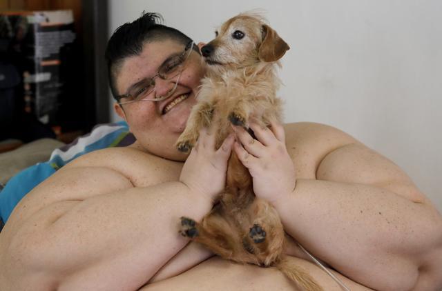 Though Franco is still connected to an oxygen tube 24 hours a day, he spends less and less time lying in bed. (AFP/ Ulises Ruiz) Though Franco is still connected to an oxygen tube 24 hours a day, he spends less and less time lying in bed. (AFP/ Ulises Ruiz)