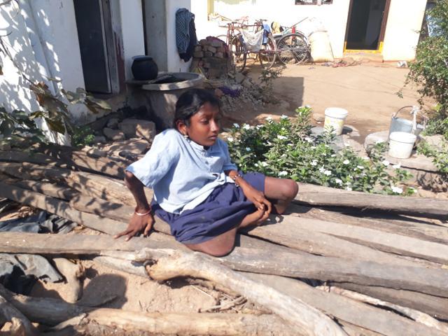 K Sirisha, 15, from Khuda Baksh Palle village in Munugode block, was affected by skeletal fluorosis when she was just three years old. Over the years, the disease completely crippled her body. “My parents carry me to the school every day,” says the class 10 girl. (HT Photo) K Sirisha, 15, from Khuda Baksh Palle village in Munugode block, was affected by skeletal fluorosis when she was just three years old. Over the years, the disease completely crippled her body. “My parents carry me to the school every day,” says the class 10 girl. (HT Photo)
