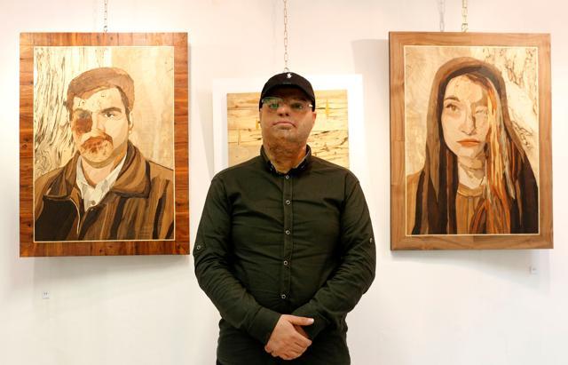 Mohsen Mortazavi, an Iranian victim of acid attack, presents his work at the Ashianeh gallery in Tehran. (AFP) Mohsen Mortazavi, an Iranian victim of acid attack, presents his work at the Ashianeh gallery in Tehran. (AFP)