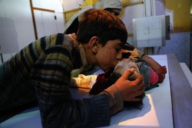 A boy kisses his relative who was wounded in government shelling in the radiography room of a hospital in Douma, in the besieged rebel-held enclave of Eastern Ghouta, on March 4. (AFP Photo) A boy kisses his relative who was wounded in government shelling in the radiography room of a hospital in Douma, in the besieged rebel-held enclave of Eastern Ghouta, on March 4. (AFP Photo)
