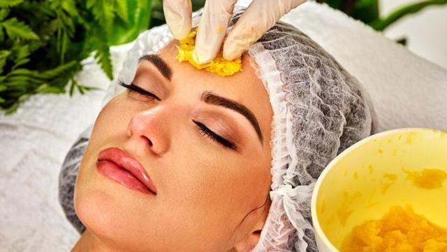 Turrmeric works as a great suntan-removing agent. (Shutterstock) Turrmeric works as a great suntan-removing agent. (Shutterstock)