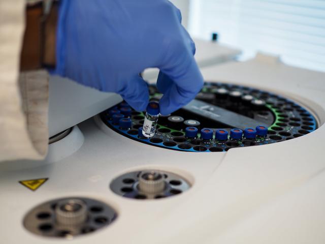 The new system of delivering glaucoma medication that has been developed at the University of British Columbia. (Clare Kiernan/UBC) The new system of delivering glaucoma medication that has been developed at the University of British Columbia. (Clare Kiernan/UBC)