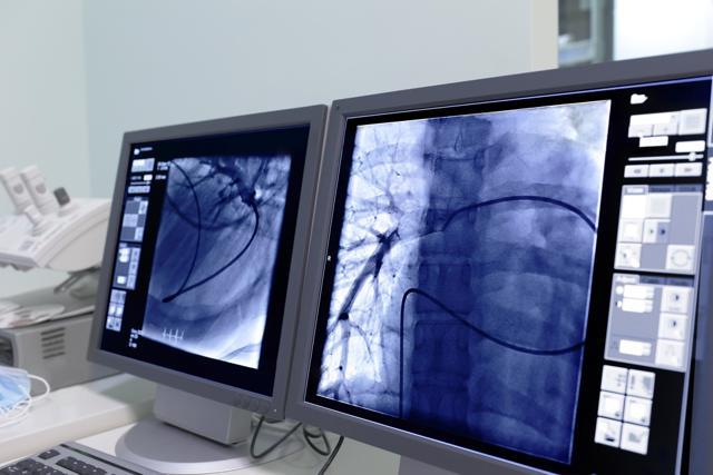 Bansal had earlier released a very basic version of the application, exploring a dental scan, on YouTube. (Shutterstock) Bansal had earlier released a very basic version of the application, exploring a dental scan, on YouTube. (Shutterstock)
