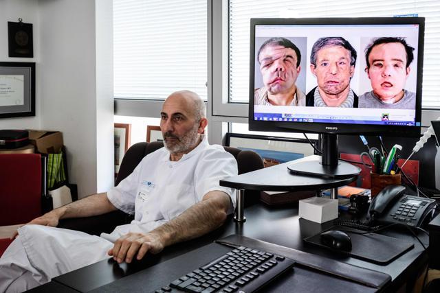 Laurent Lantieri poses next to a screen showing different steps of his patient Jerome Hamon's surgery on April 13, 2018. (AFP Photo) Laurent Lantieri poses next to a screen showing different steps of his patient Jerome Hamon's surgery on April 13, 2018. (AFP Photo)