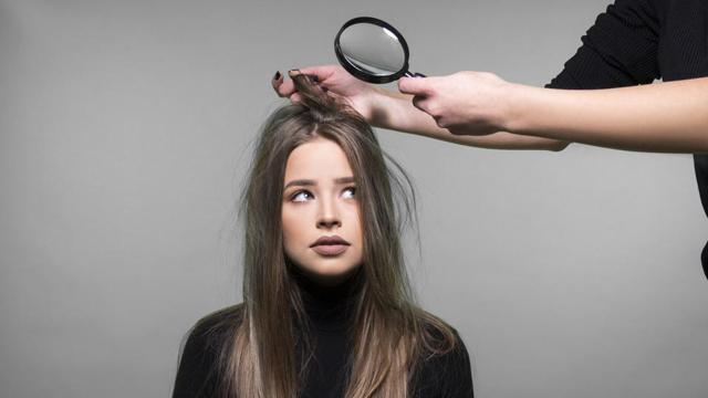 Find out if you have a combination scalp, an oily one or the one that is prone to dryness. (Shutterstock) Find out if you have a combination scalp, an oily one or the one that is prone to dryness. (Shutterstock)