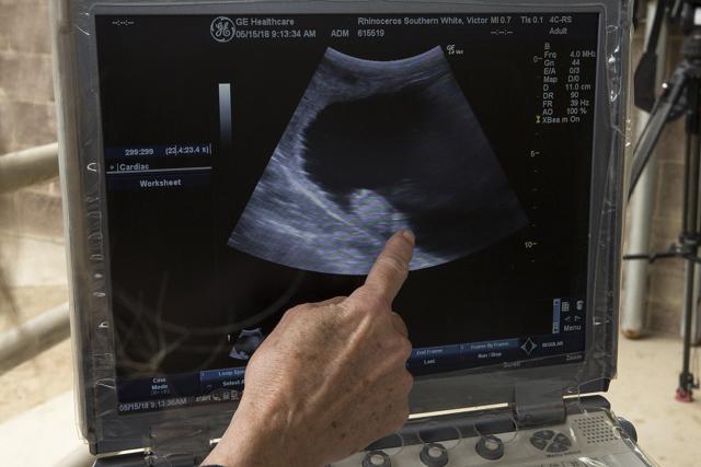 A researcher point to the newest ultrasound of Victori. (AP Photo) A researcher point to the newest ultrasound of Victori. (AP Photo)