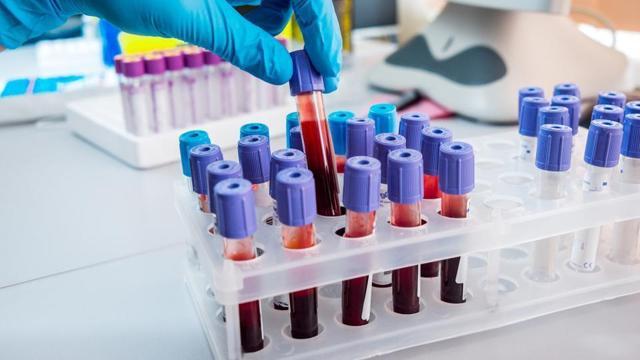 An immune breakthrough for bowel, breast and ovary cancer remains elusive. (Shutterstock) An immune breakthrough for bowel, breast and ovary cancer remains elusive. (Shutterstock)