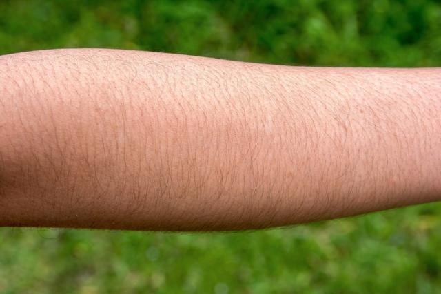 Polycystic ovary syndrome could be a reason for excess hair growth. (Shutterstock) Polycystic ovary syndrome could be a reason for excess hair growth. (Shutterstock)