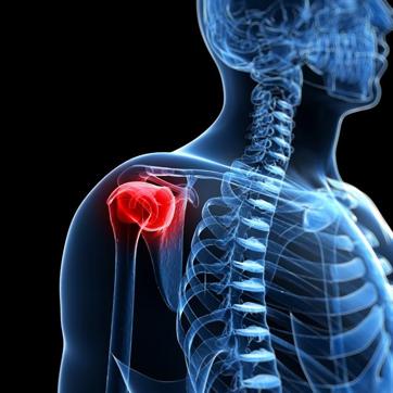 An ice pack can also provide some relief from a frozen shoulder. (Shutterstock) An ice pack can also provide some relief from a frozen shoulder. (Shutterstock)