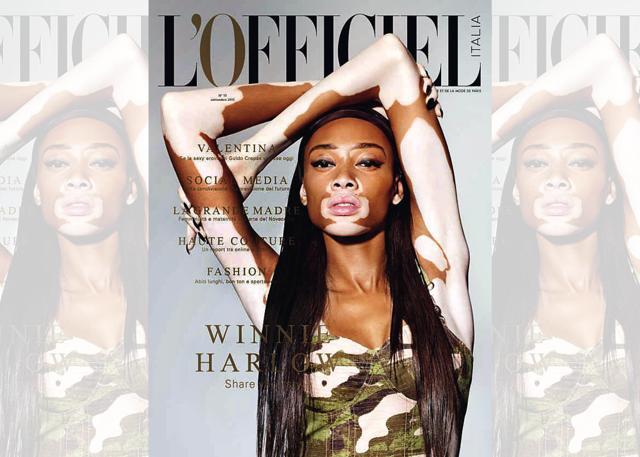 Winnie Harlow on the cover of L’Officiel Italia Winnie Harlow on the cover of L’Officiel Italia