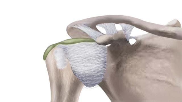 The shoulder is the most mobile joint in the body (Illustration: Mitrarun Haldar) The shoulder is the most mobile joint in the body (Illustration: Mitrarun Haldar)
