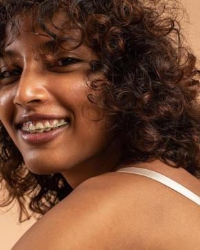 Model Namita is not insecure about doing shoots with braces on (Arka_Patra/Instagram) Model Namita is not insecure about doing shoots with braces on (Arka_Patra/Instagram)
