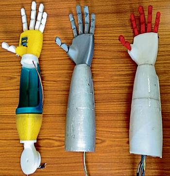 The 3D-printed prosthetic arms made by a mechanical engineering student from Bengaluru cost less than ₹10,000. The 3D-printed prosthetic arms made by a mechanical engineering student from Bengaluru cost less than ₹10,000.